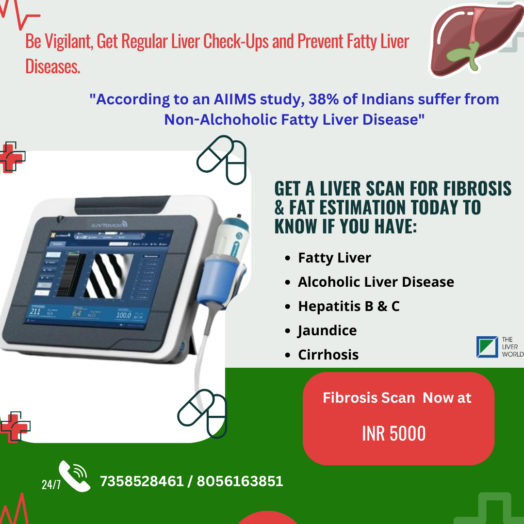 Fibrosis Scan