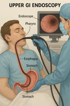 Upper GI Endoscopy..