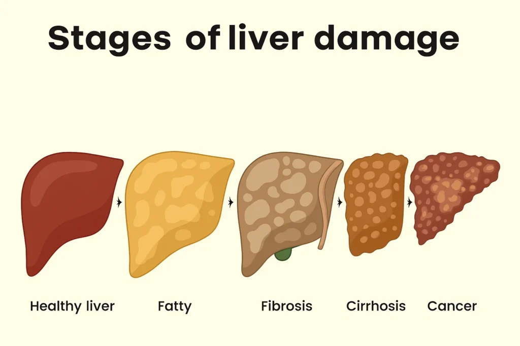 Stages of Liver Damage